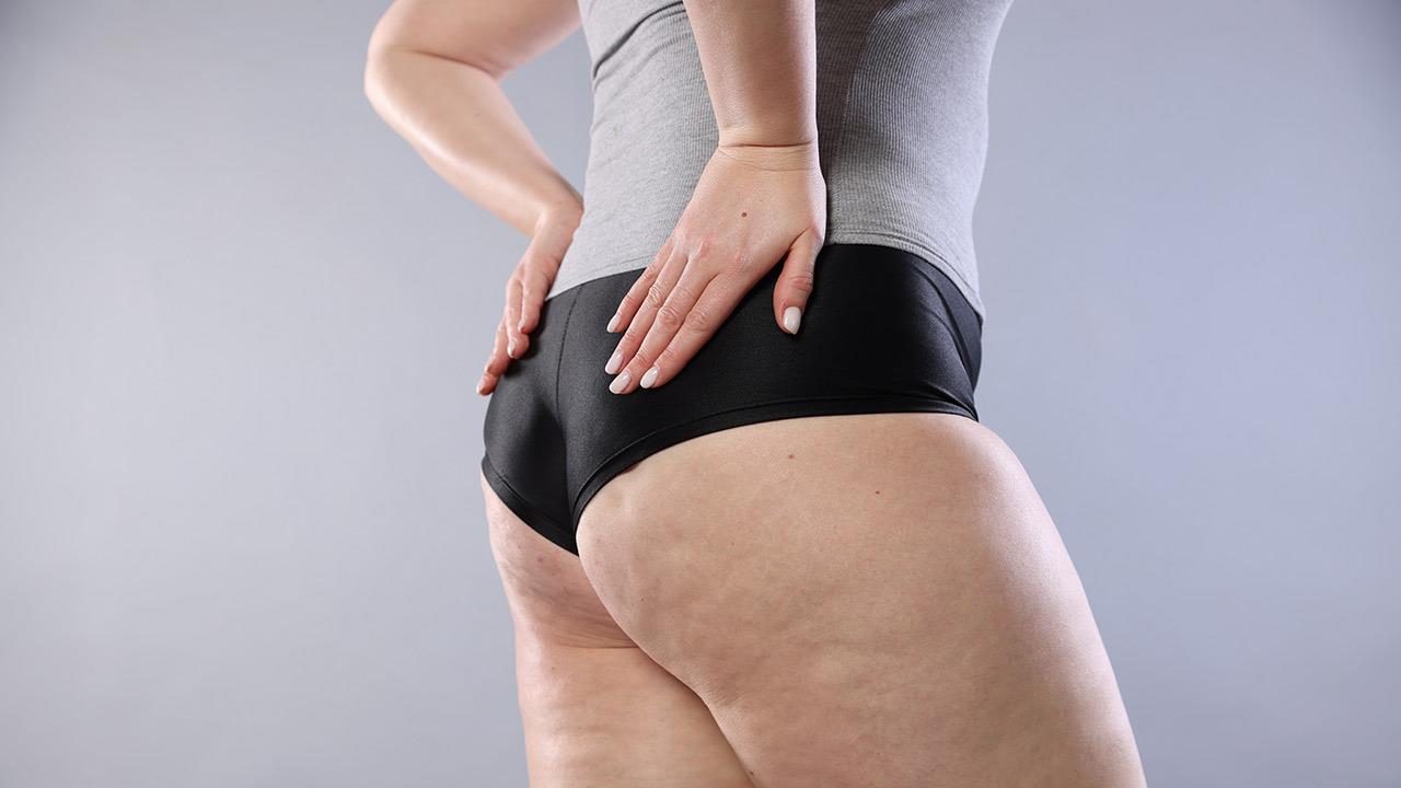 Μεσοθεραπεία σώματος: Στοχευμένη ιατρική λύση για κυτταρίτιδα και τοπικό λίπος