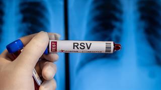 RSV: Πρώτη έκθεση από τον Παγκόσμιο Οργανισμό Υγείας για τον ιό