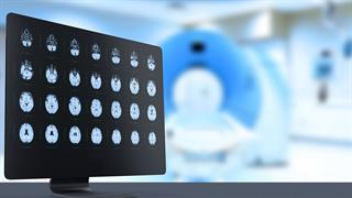 Νέο φάρμακο δείχνει να καταπολεμά τους όγκους