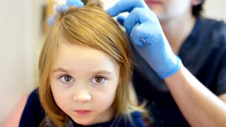 Ψείρες:  Όσα πρέπει να γνωρίζετε