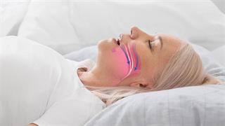 Μελέτη συνδέει την υπνική άπνοια με τη νόσο του Πάρκινσον