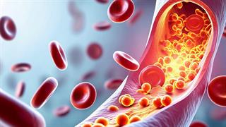 Ποιοι παράγοντες επηρεάζουν τη χοληστερόλη