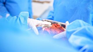 Ερευνητές κατέγραψαν για πρώτη φορά πώς αντιδρά το ανθρώπινο ανοσοποιητικό σε νεφρό χοίρου