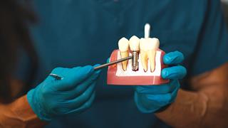 Οδοντίατροι: Προσοχή σε παραπλανητικές διαφημίσεις για 