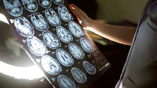 Μικραίνει ο εγκέφαλος όσο μεγαλώνουμε;