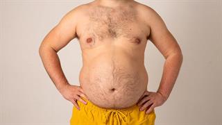 Τριπλάσιος κίνδυνος για σύνδρομο long CoViD σε παχύσαρκους νέους άνδρες [μελέτη]