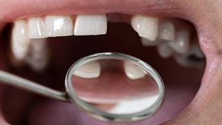 Στοματική υγεία και ποιότητα ζωής στην Ελλάδα [μελέτη]