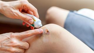 Επούλωση τραυμάτων: Ελπίδα για θεραπεία χωρίς αντιβιοτικά