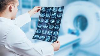 Αίτημα για αναπροσαρμογή της κοστολόγησης των απεικονιστικών εξετάσεων κατά 30%.