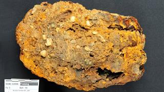 Σπάνια ασθένεια διαγνώστηκε μέσω DNA σε σκελετούς της Λίθινης Εποχής