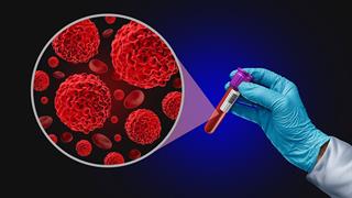 Παράλογος ο τρόπος που αποζημιώνονται οι βιοδείκτες - Τι πρέπει να αλλάξει