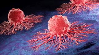 ΠΟΥ: 40% των καρκίνων παγκοσμίως μπορεί να προληφθεί