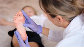 ECDC: Σημαντική μείωση κρουσμάτων ιλαράς - Παραμένουν διπλάσια από το 2023