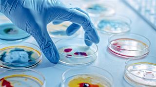 ECDC: Υψηλή μικροβιακή αντοχή σε ανθρώπους και ζώα στην Ελλάδα