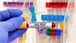 Εξέταση PSA για τον προστάτη: Εξίσου αξιόπιστη με τη μαστογραφία (μελέτη)