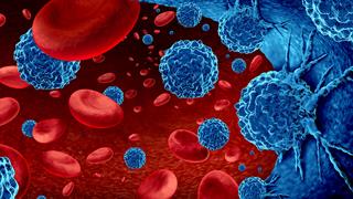 Πολλαπλό μυέλωμα: Νέα γενιά φαρμάκων δημιουργεί ελπίδες