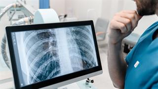 Φυματίωση - ECDC: Αδιάγνωστο 1 στα 5 κρούσματα στην Ευρώπη - Τι γίνεται στην Ελλάδα