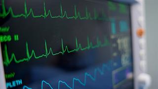 Επέμβαση - ελπίδα για σωτηρία από τις καρδιακές αρρυθμίες