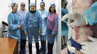 Δυστροφική πομφολυγώδης επιδερμόλυση: Επιτυχής η πρώτη χορήγηση γονιδιακής θεραπείας