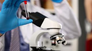 Νέος ελπιδοφόρος παράγοντας κατά της ηπατίτιδας Ε