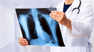 Φυσική κατάσταση και παλμοί της καρδιάς επηρεάζουν την εκδήλωση Long CοViD