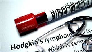 Λέμφωμα Hodgkin:  Tο nivolumab σε συνδυασμό με το σχήμα χημειοθεραπείας AVD έλαβε διευρυμένη έγκριση στην ΕΕ