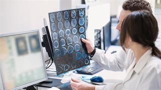 Χαμηλή πίεση και Alzheimer: Τι αποκαλύπτει νέα μελέτη